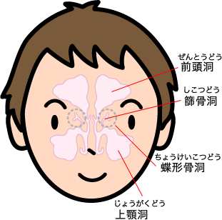 副鼻腔炎